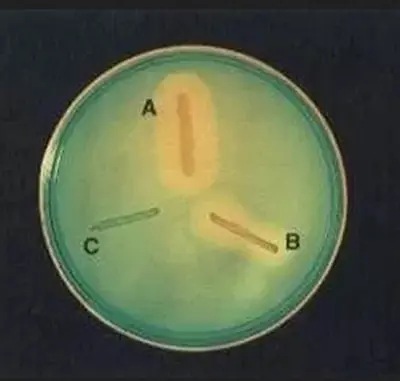 DNase test