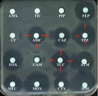 Bêta-lactamases à spectre étendu (BLSE)