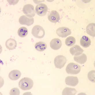 Babesia