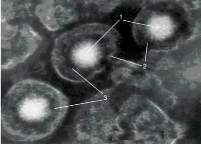 Structure du cytomégalovirus en microscopie électronique  