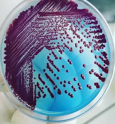   Cled agar