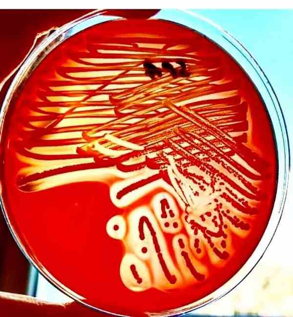 Columbia agar