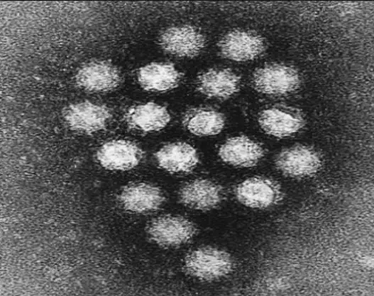 sapovirus