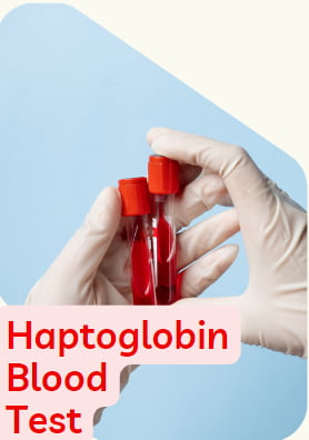 haptoglobin test