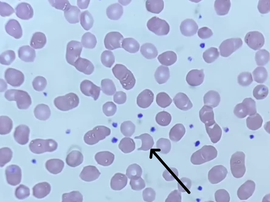 Keratocytes