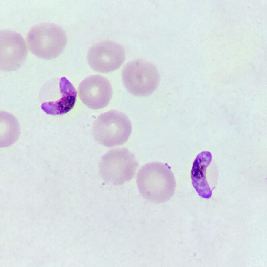 Plasmodium-falciparum