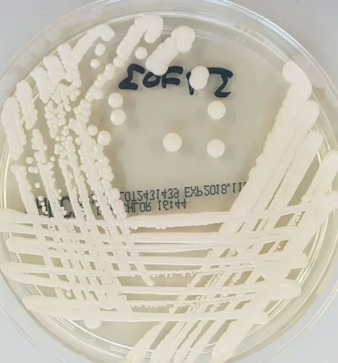 Sabouraud Dextrose Agar 