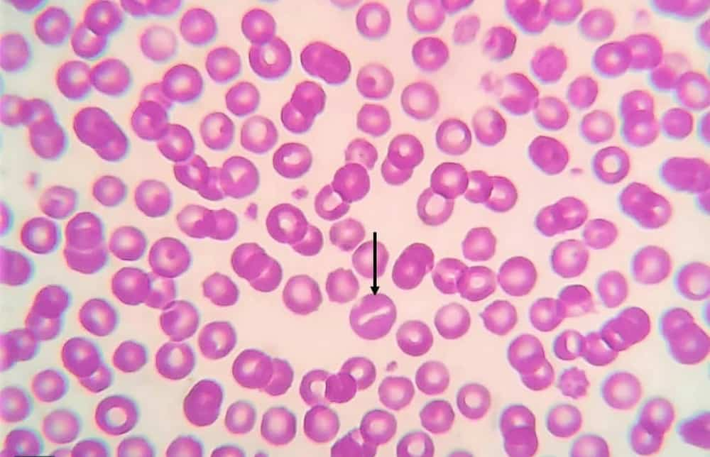 Stomatocyte