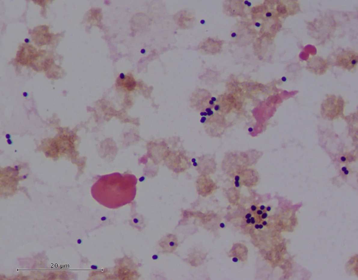 Acinetobacter appear as Gram-positive cocci