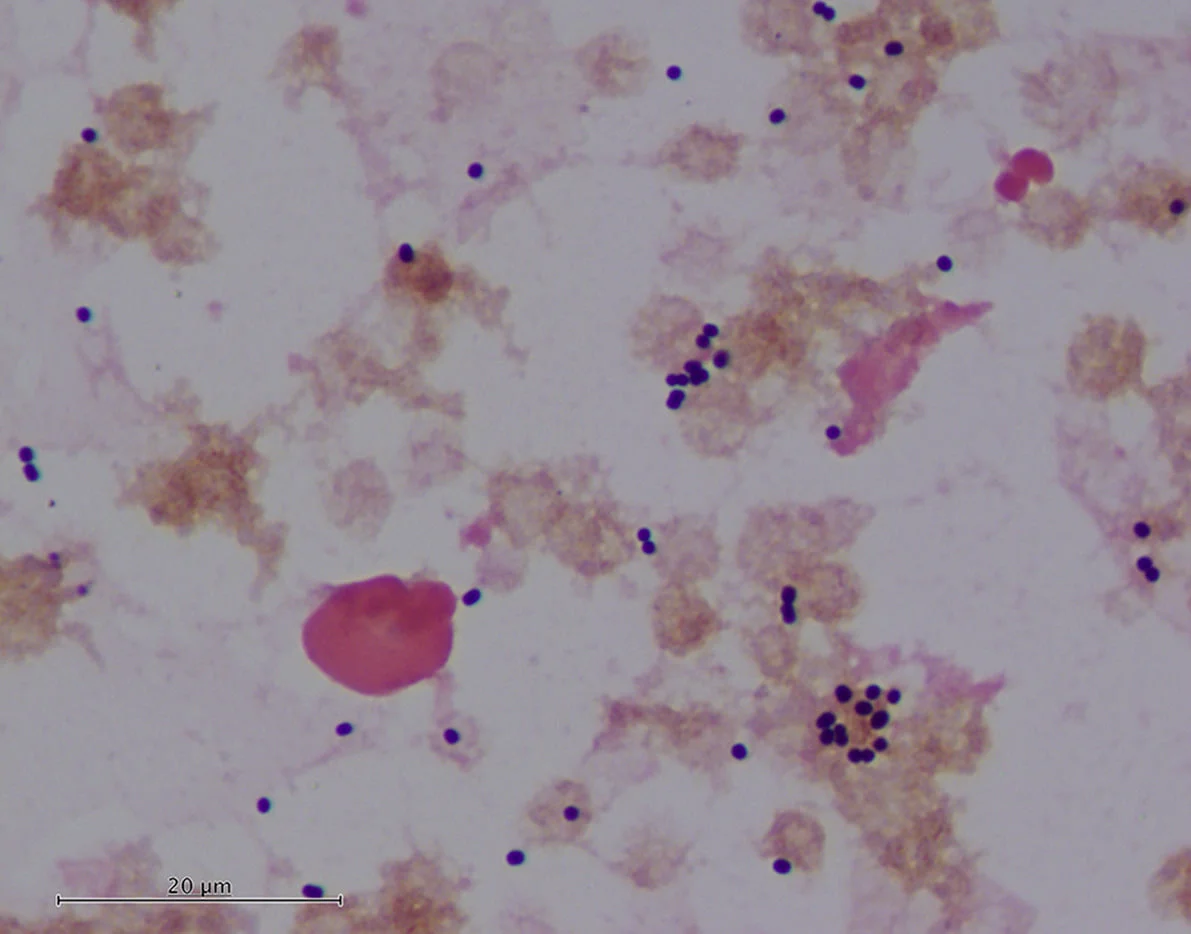 Acinetobacter gram stain 
