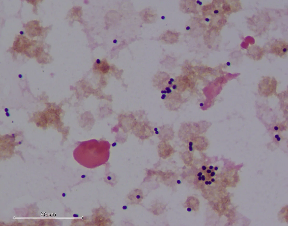 pseudomonas-gram-mucoide 