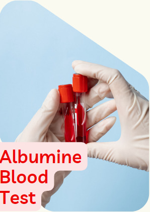 albumin blood test