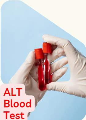 alt-blood-test