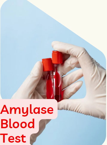 amylase blood test