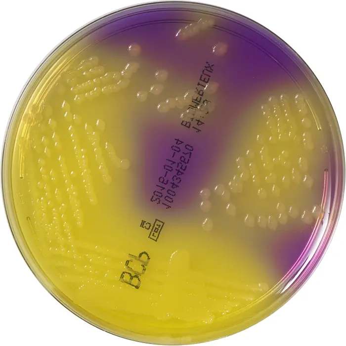 BCP agar