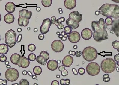 Carbonate de calcium