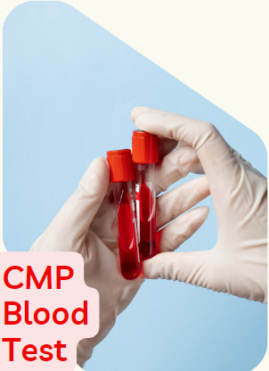 comprehensive metabolic panel (CMP)
