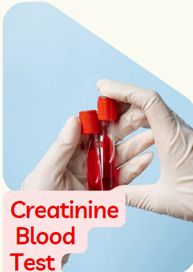 creatinine blood test