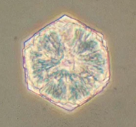 cristaux de cystine