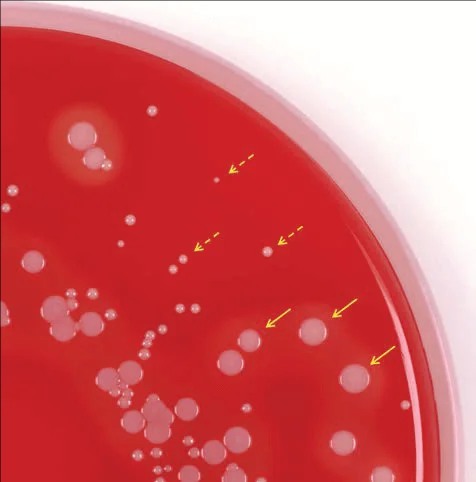 variants formant colonies naines Staphylococcus 