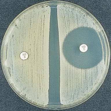 résistance à la novobiocine staphylocoque 