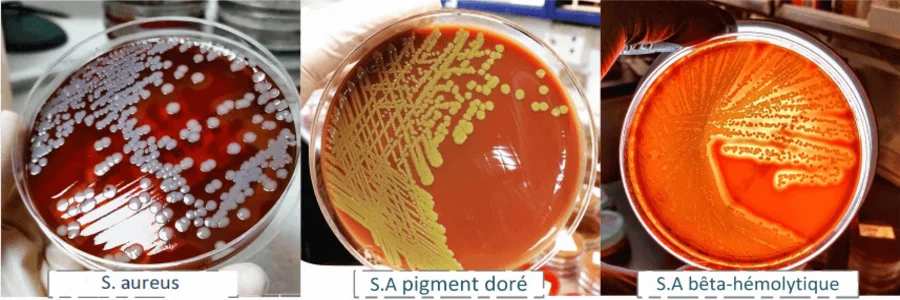 culture Staphylococcus aureus