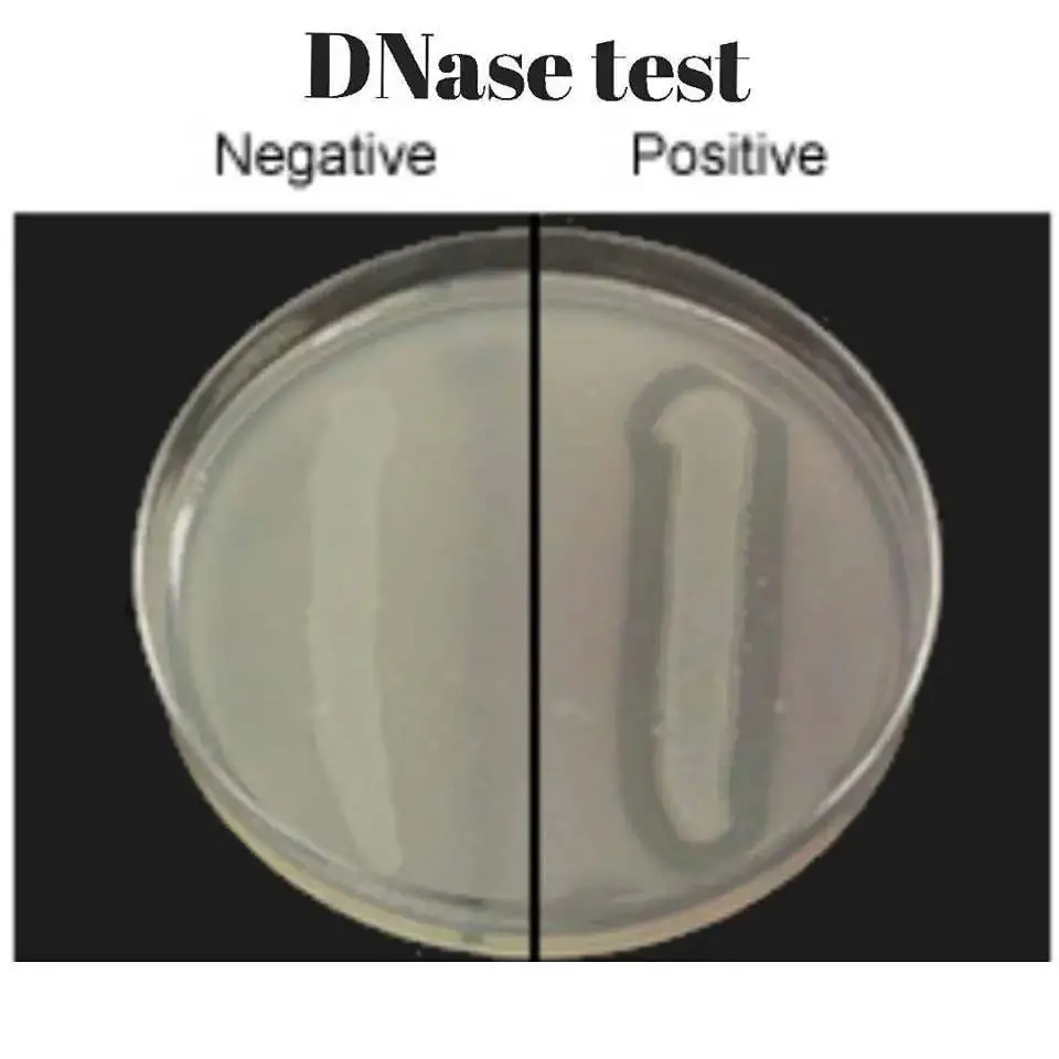 DNase test