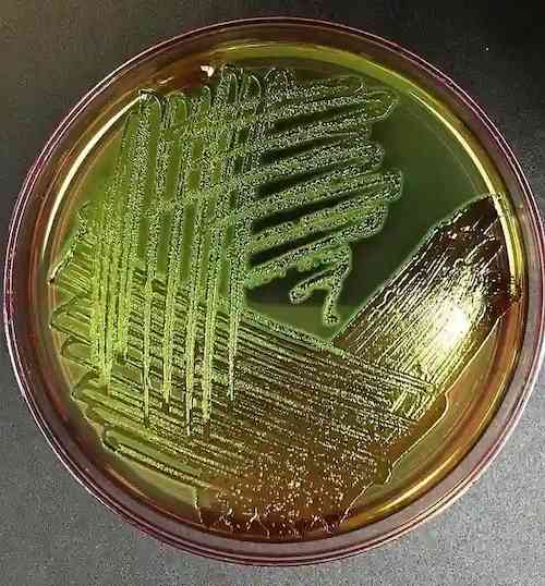  EMB Agar