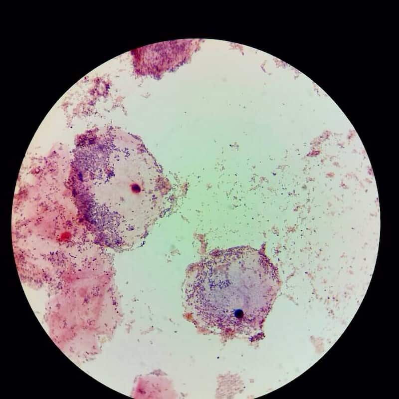 microscopic examination clue cells
