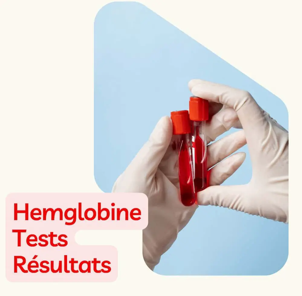 hemoglobine test