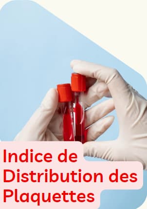 Indice de Distribution des Plaquettes (IDP)