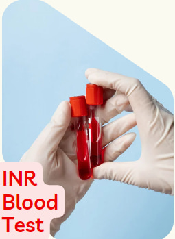 INR blood test
