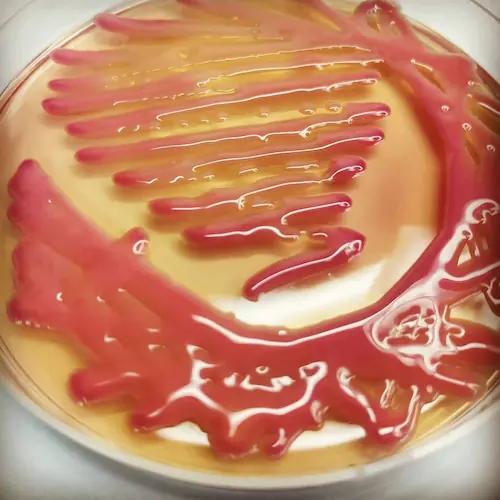 Macconkey agar