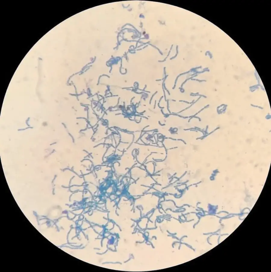  Lactobacillus stained with methylene blue