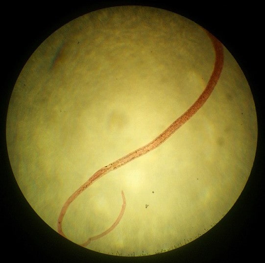 Larves de Schistosoma, femelle adulte