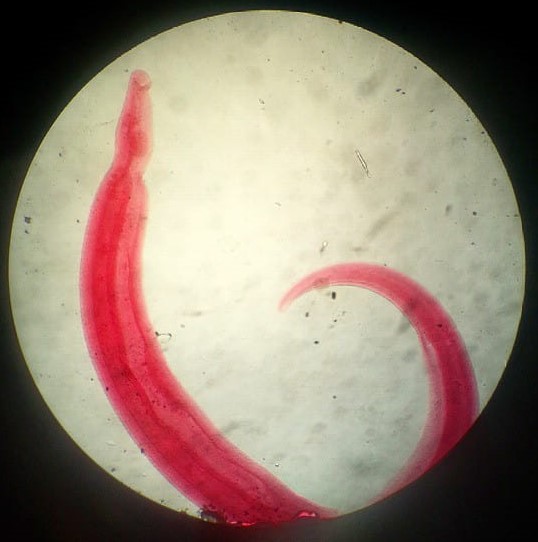 Larves de Schistosoma, mâle adulte