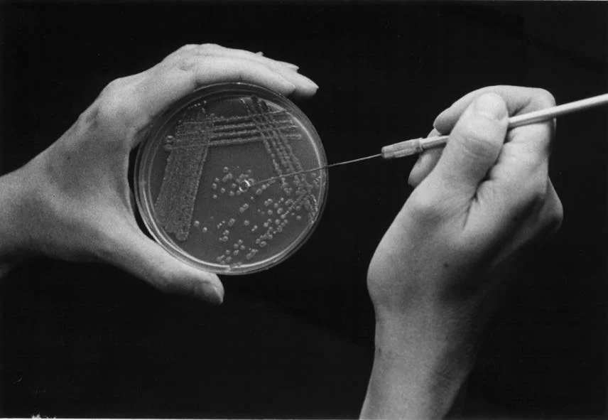 bacteriological inoculation loop 