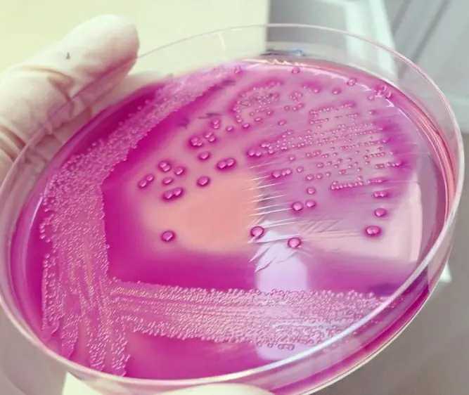 Escherichia coli on MacConkey