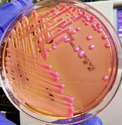 Klebsiella on MacConkey