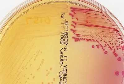 MacConkey with sorbitol
