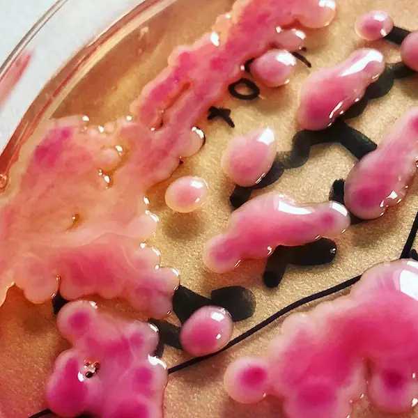 Mucous strain of Klebsiella on MacConkey agar
