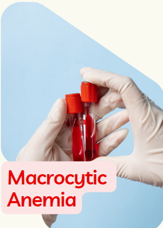 anémie macrocytaire