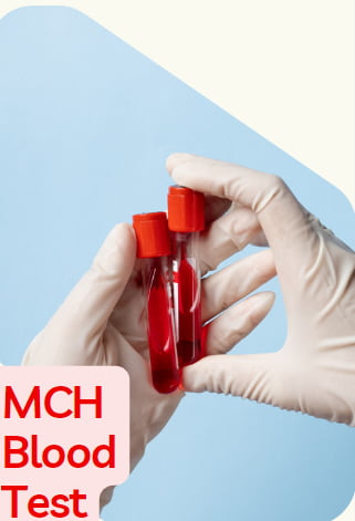 MCH blood Test