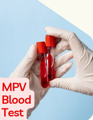 MPV blood test