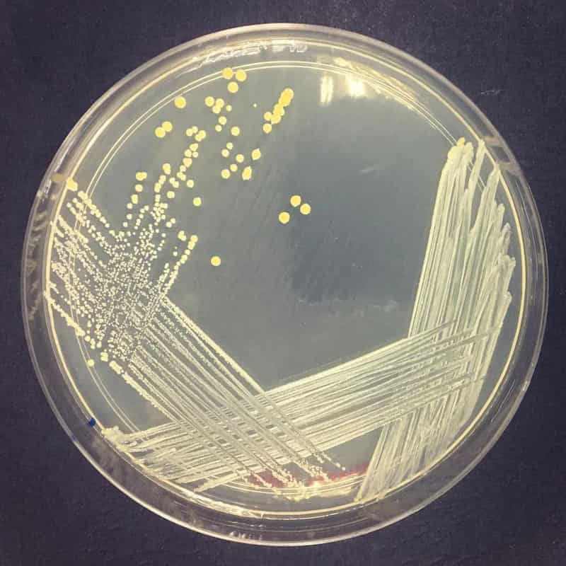 Staphylococcus aureus  on nutrient agar 