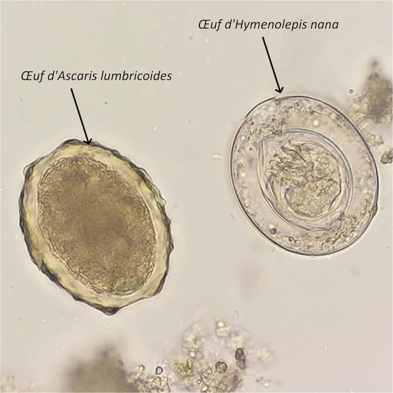 oeuf hymenolepis-nana