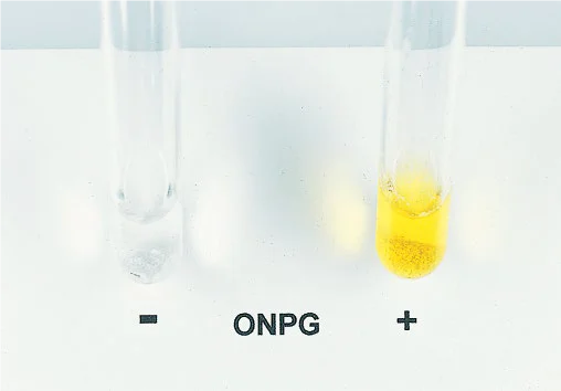 onpg Procedure