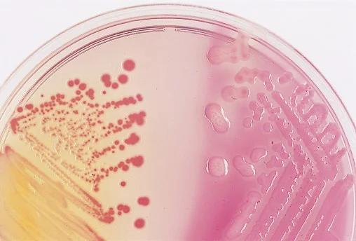 >Enterobacter on MacConkey