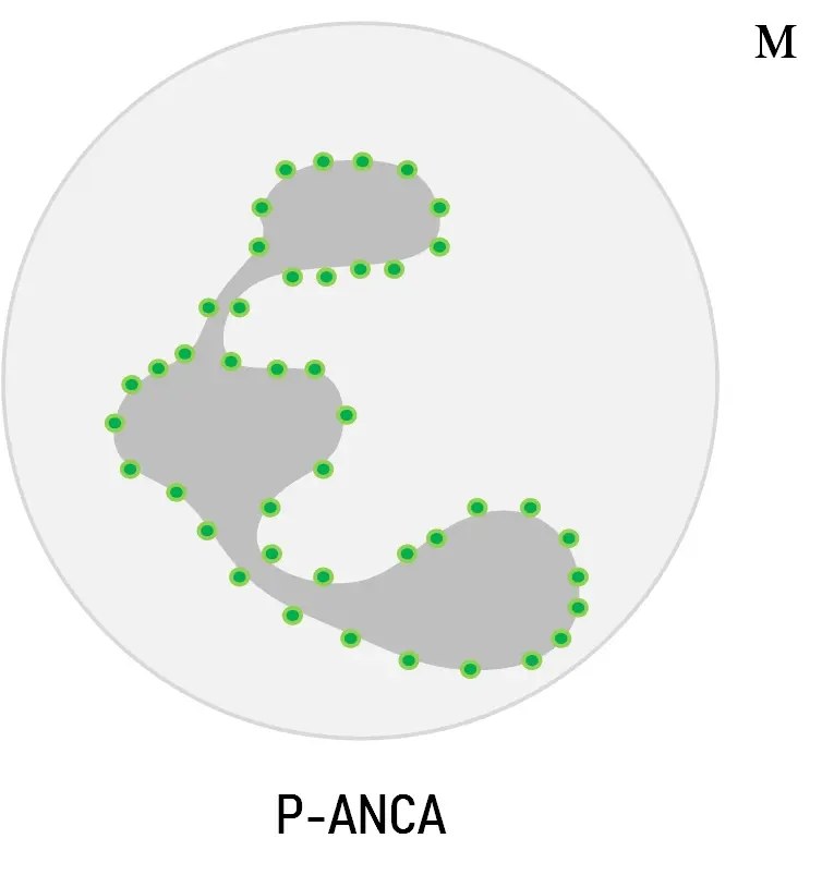 p-anca 