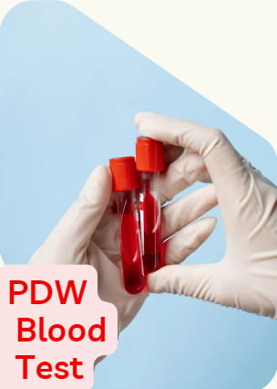 PDW blood test